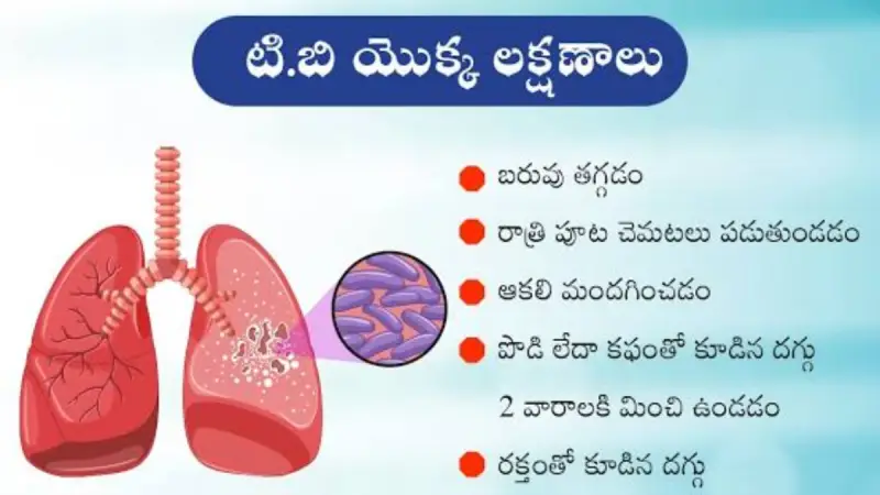 టీబీతో జాగ్రత్త.. ఉమ్మడి నల్గొండలో భారీగా కేసులు